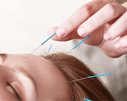 Acupuncture and Massage Therapy